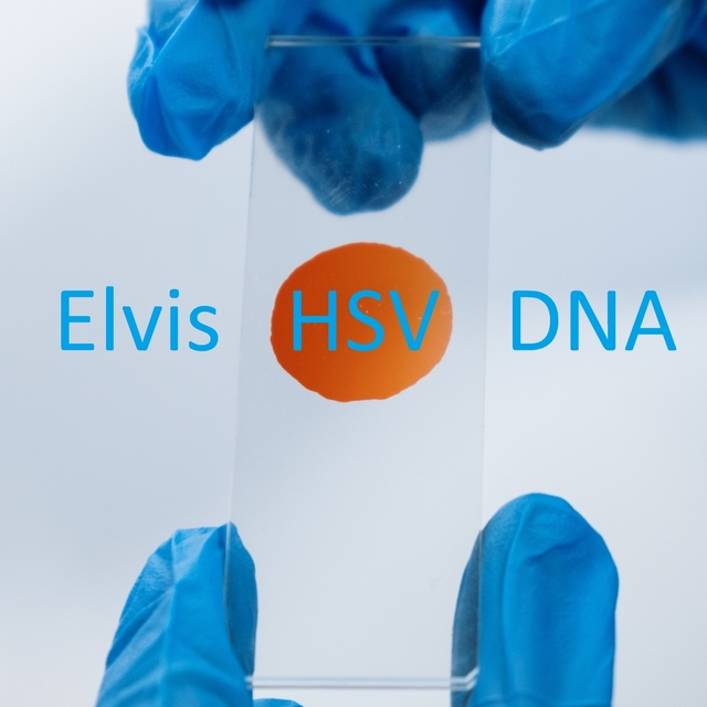 Couverture de HSV DNA