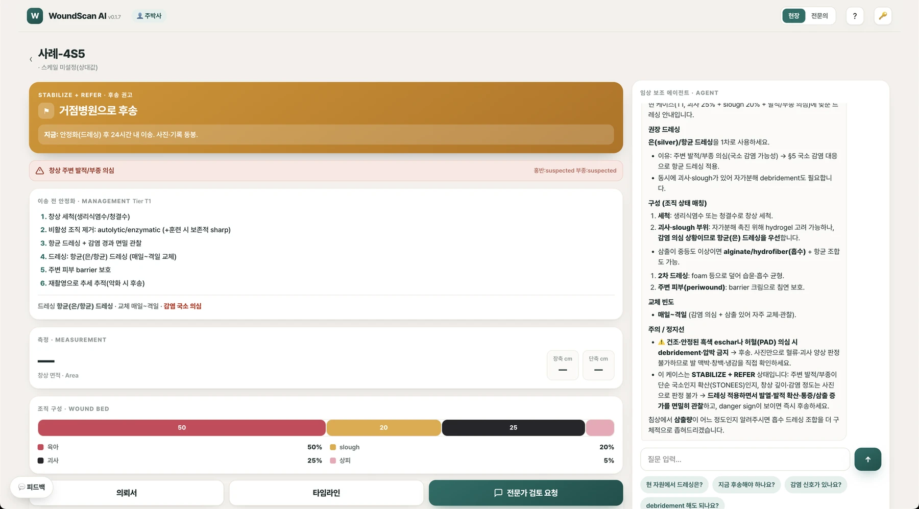 WoundScan AI 상처 측정과 경과 비교 화면