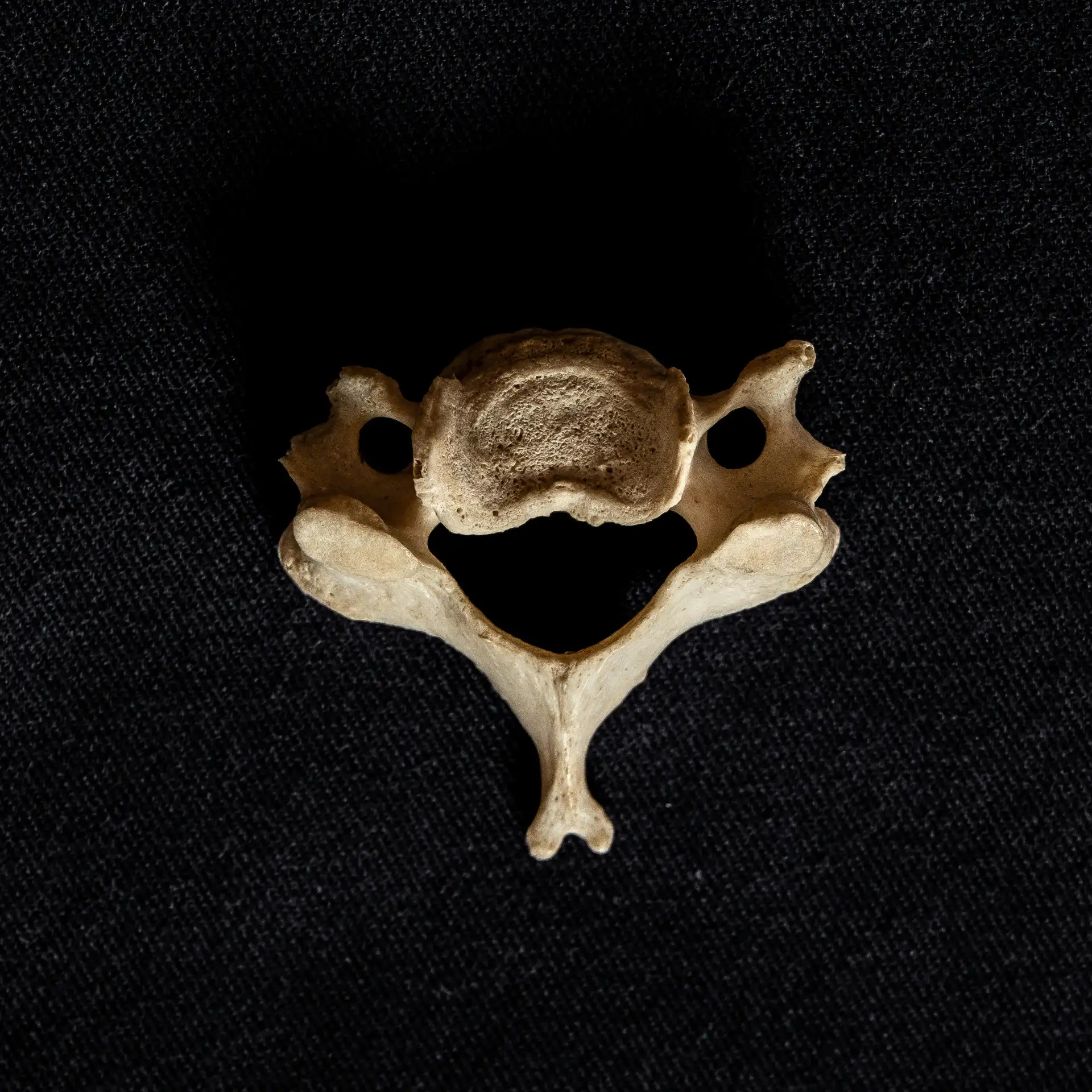 מה זה אוסטאופתיה ?