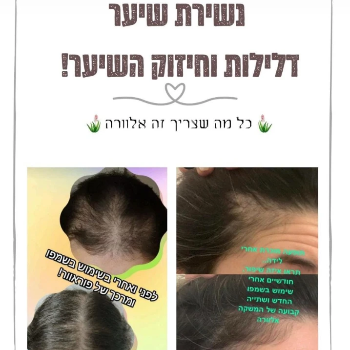 טיפול בערכה לשיער השיער שלפני הטיפולי בערכה והתוצאות שמדברות בעד עצמן