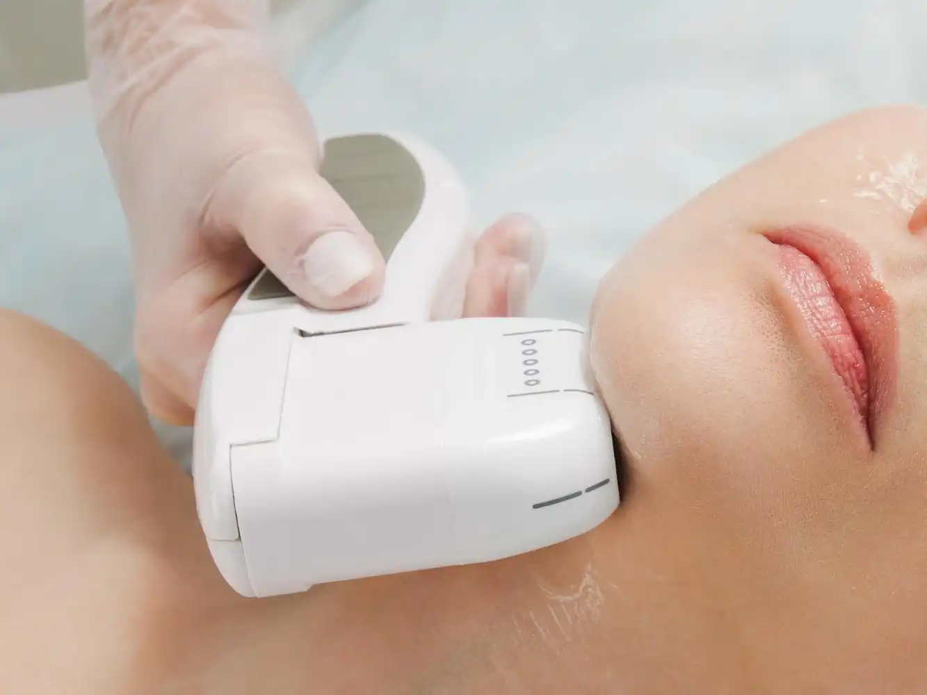 Storming HIFU – מהפכה בטיפולים אסתטיים לא־פולשניים