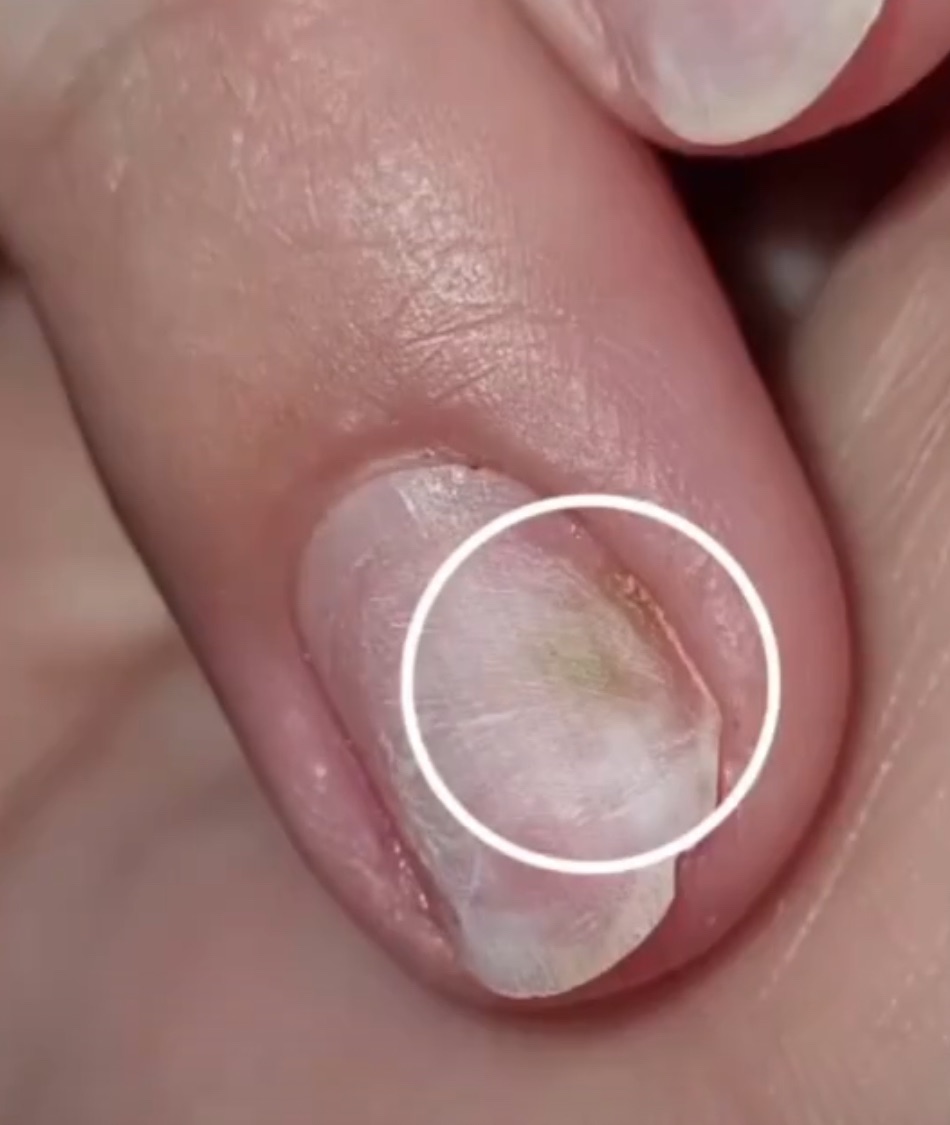 ירקת היא פטריה?