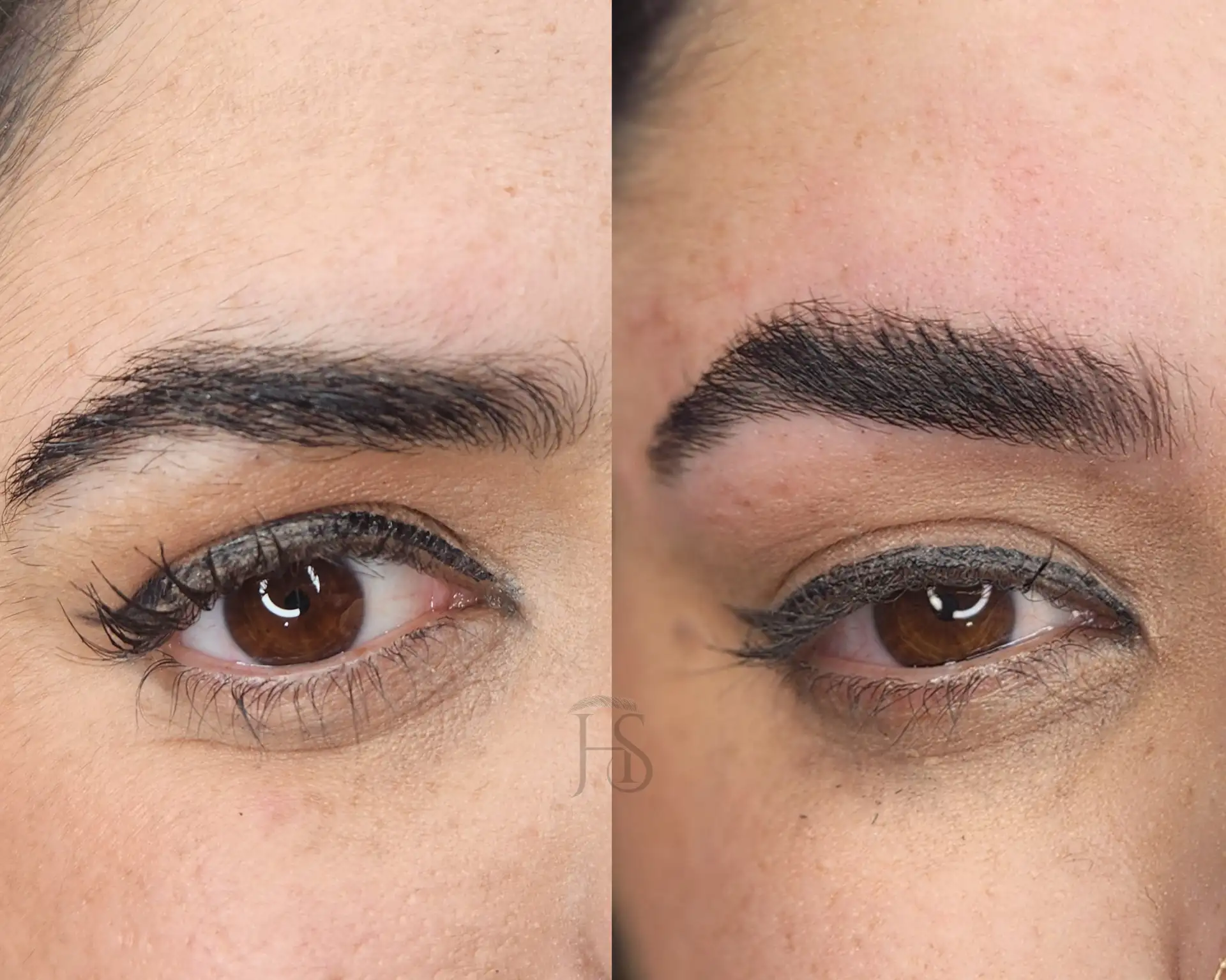 עיצוב ושיקום הגבות