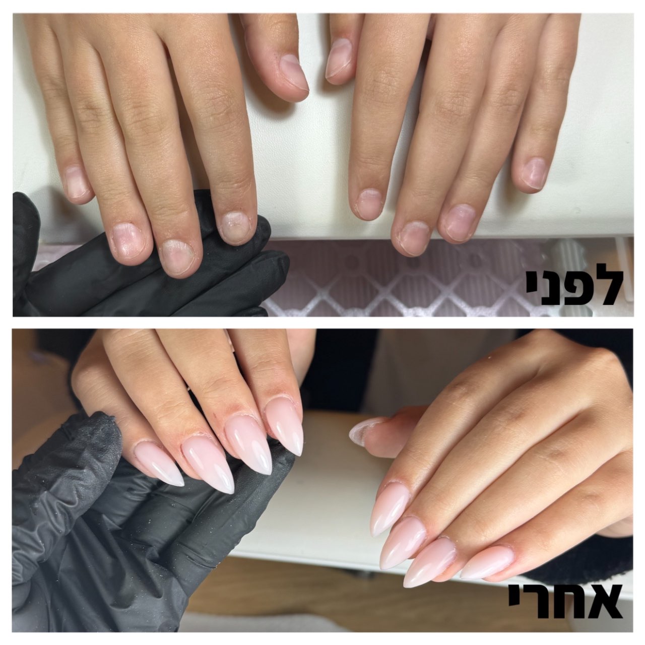 שיקום הציפורניים