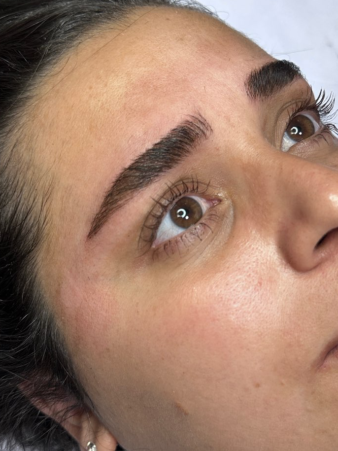 מיקרובליידינג