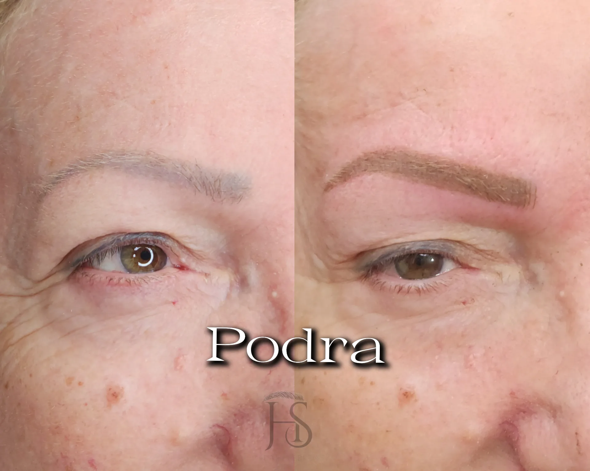 טיפול משולב