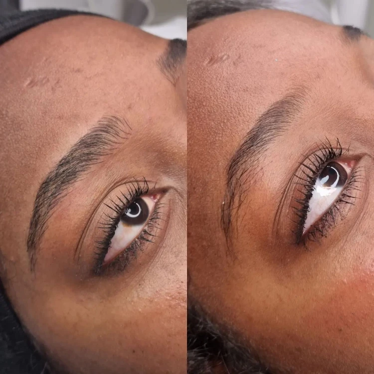 מיקרובליידינג