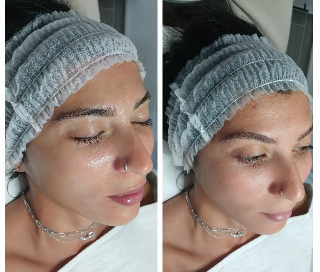 החדרת לחות באלקטרופורציה