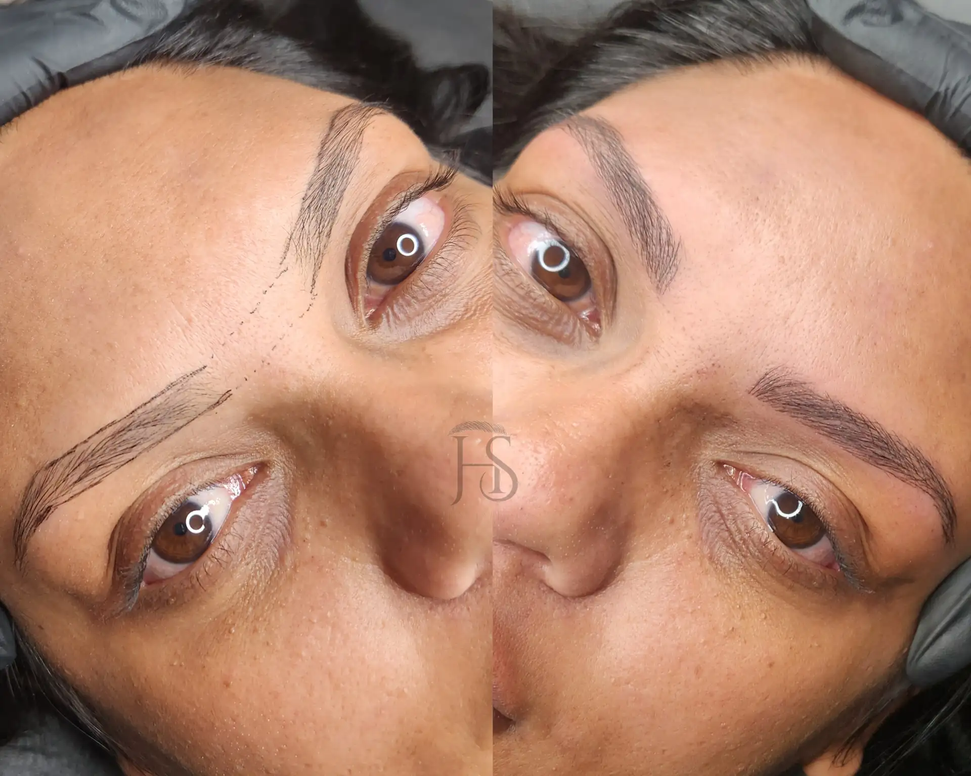 מיקרובליידינג