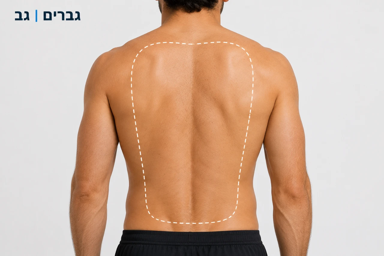 הסרת שיער גב גבר 10 טיפולים