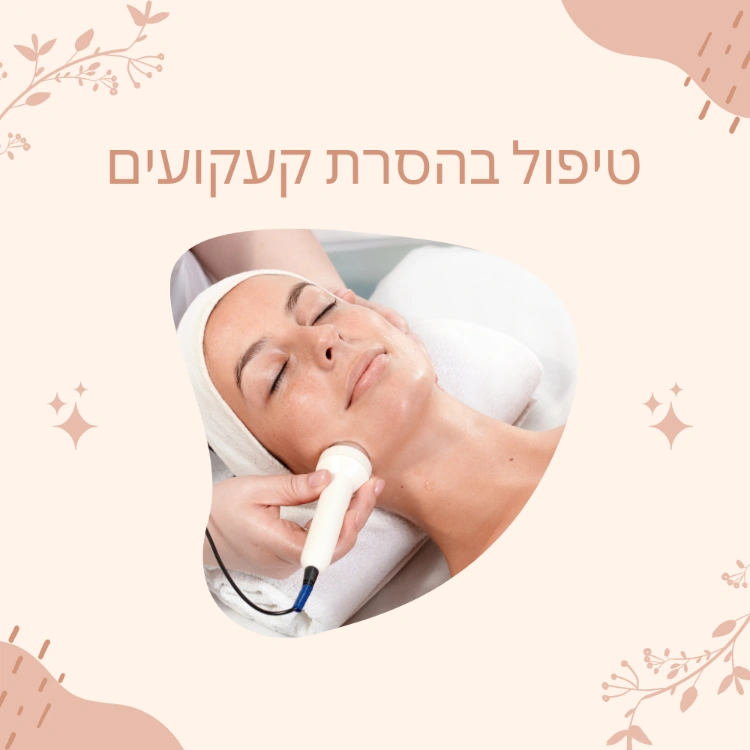 טיפול בהסרת קעקועים