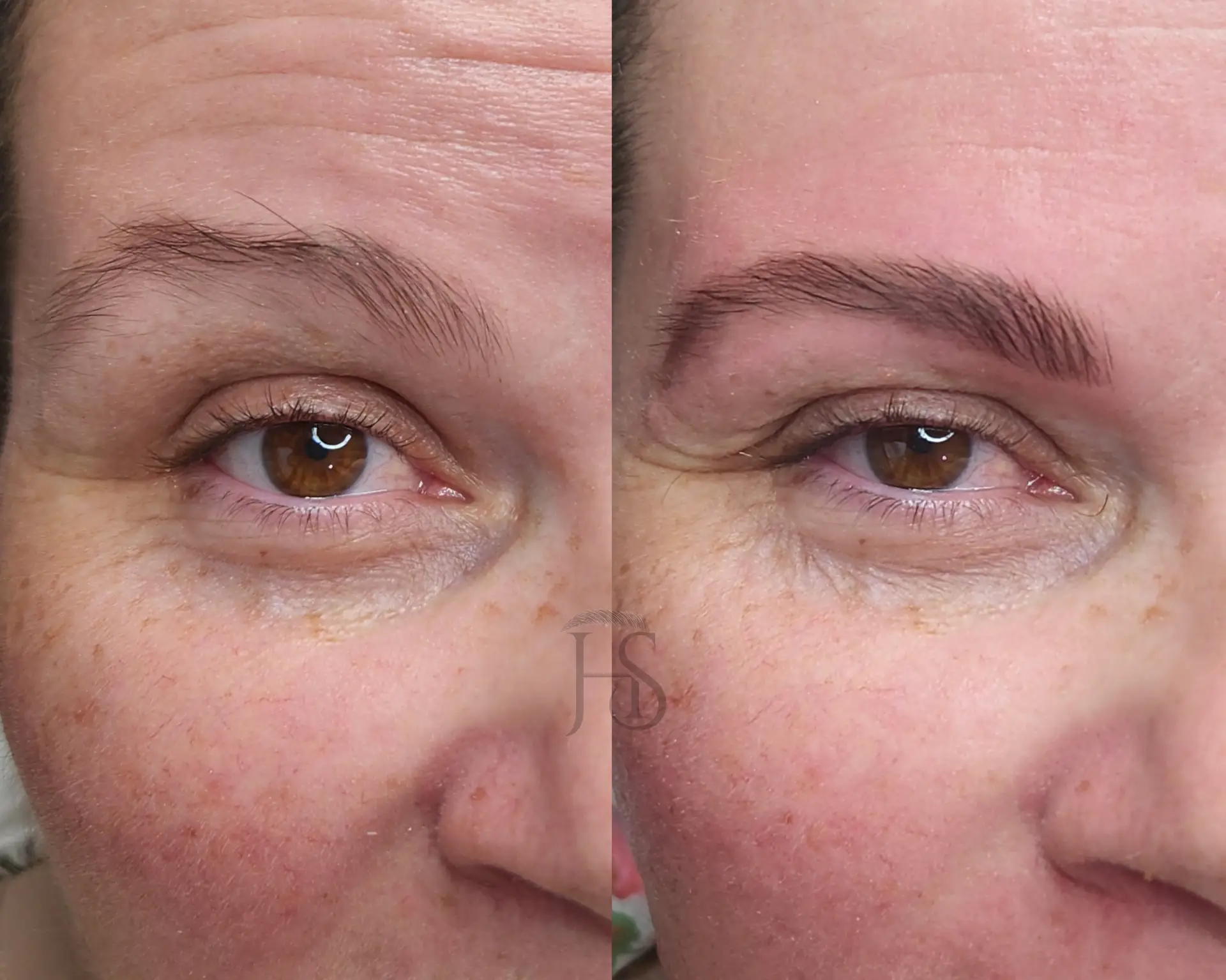 עיצוב ושיקום הגבות