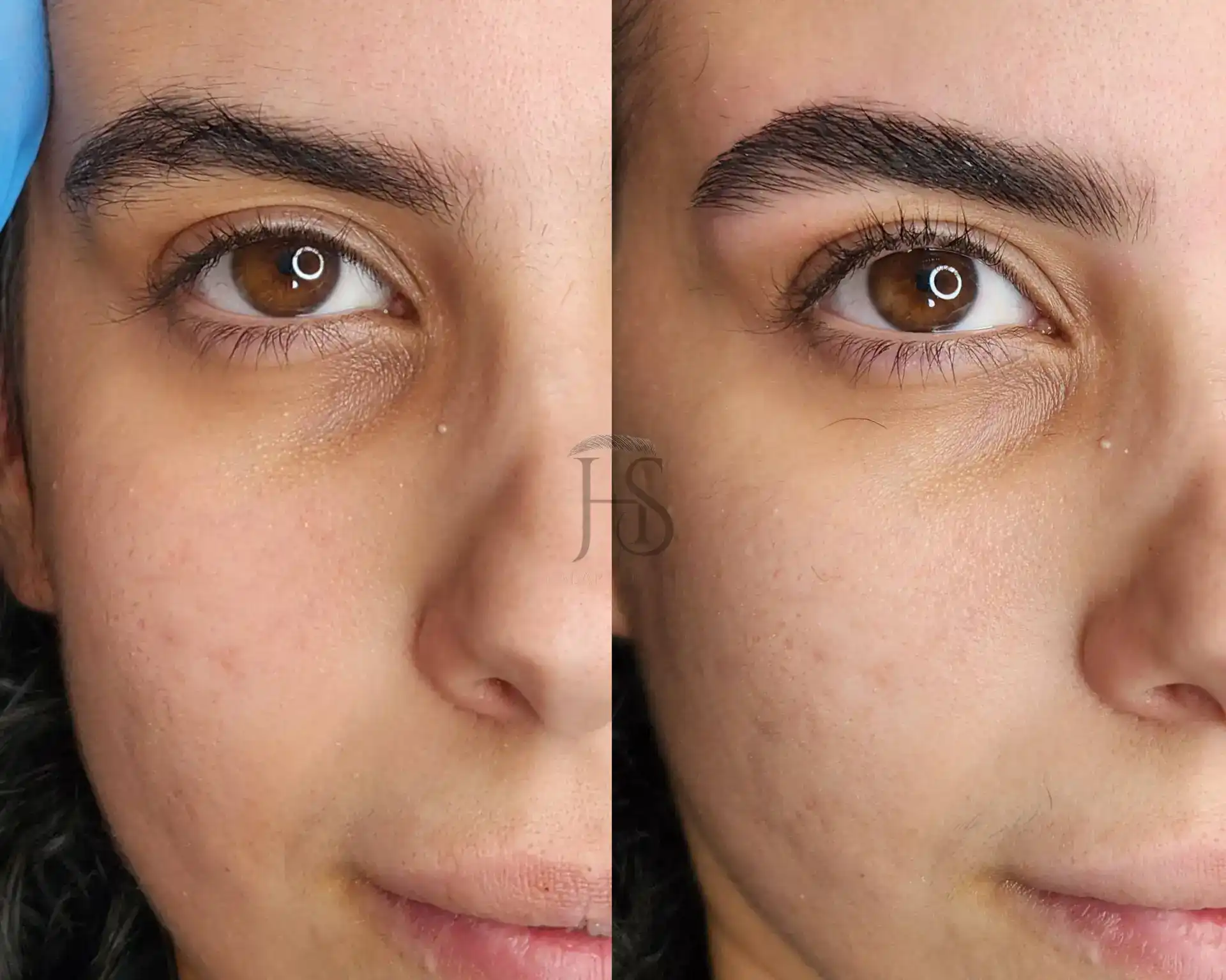 עיצוב ושיקום הגבות