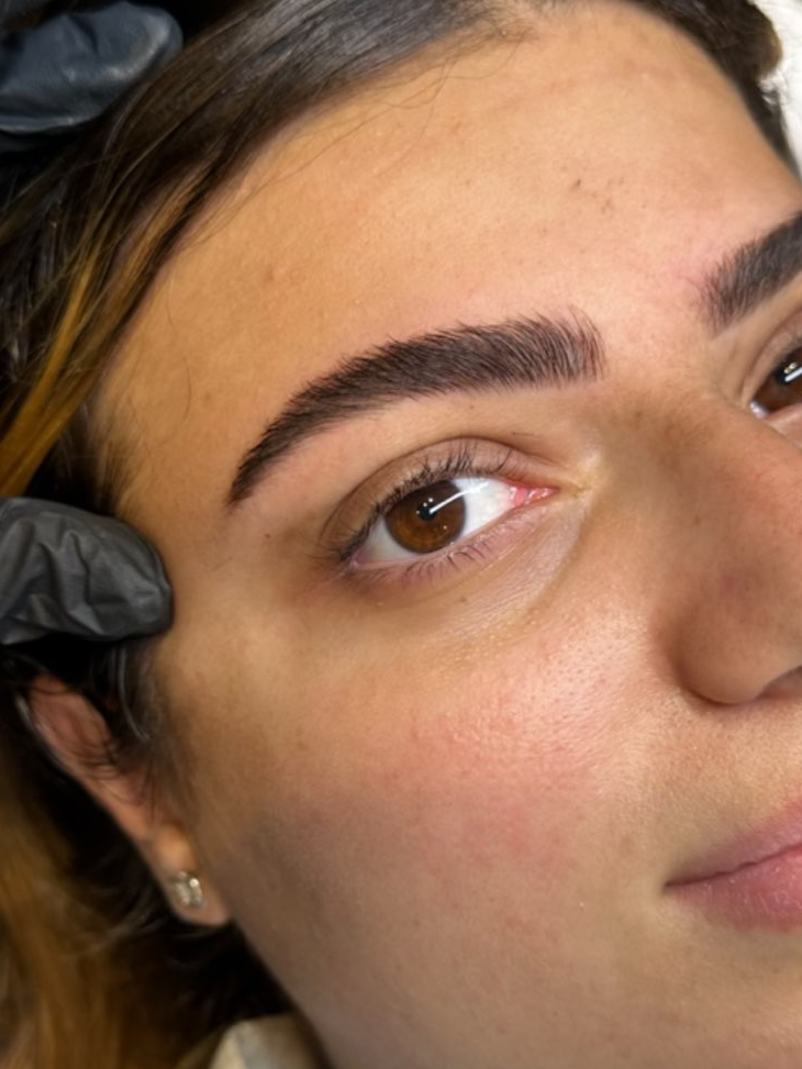 מיקרובליידינג