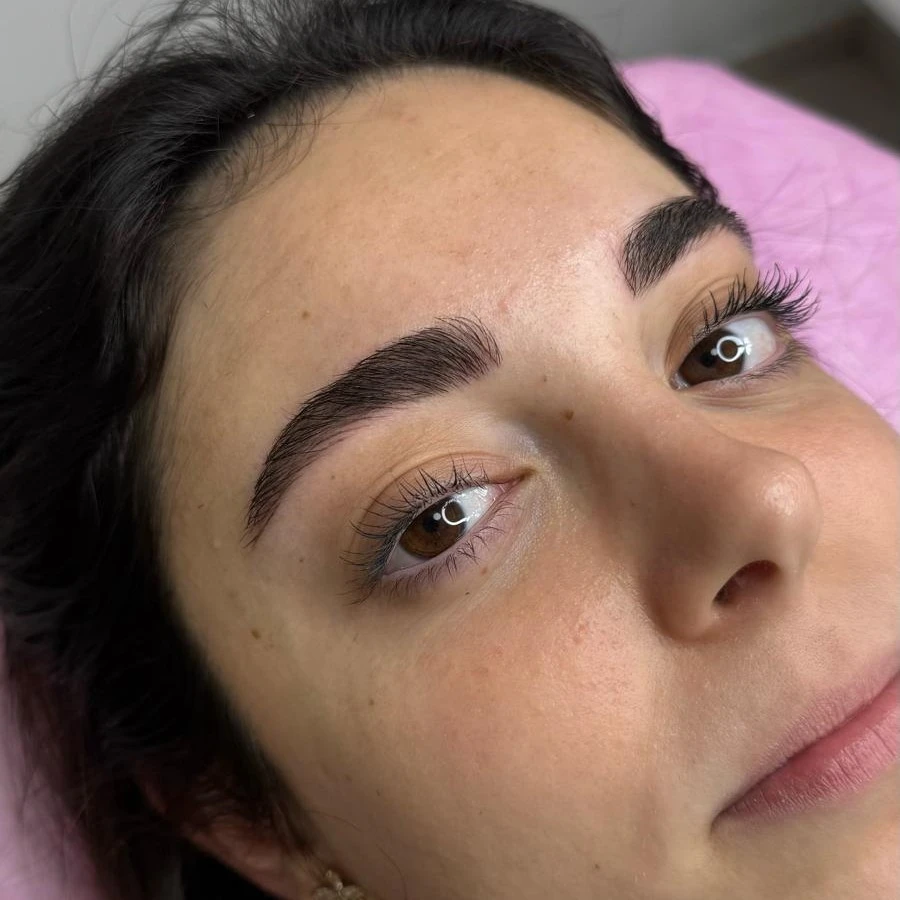 טיפול מיקרובליידינג