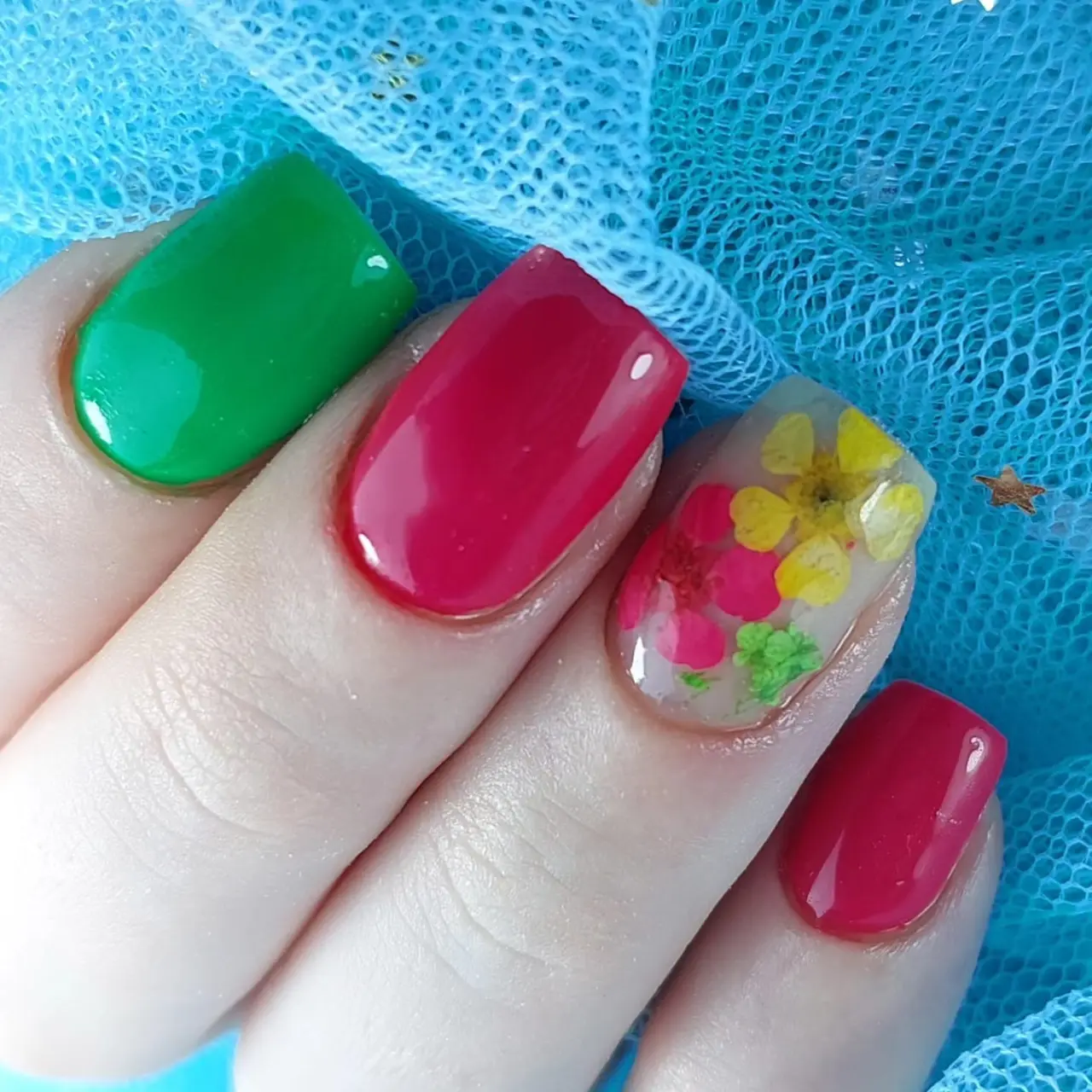 תיקון מבנה אנטומי עם לק ג'ל