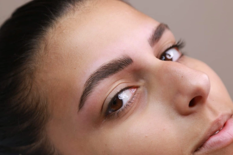 מיקרובליידינג