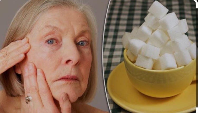  סימני הזדקנות כתוצאה מאכילה מרובה של סוכר 