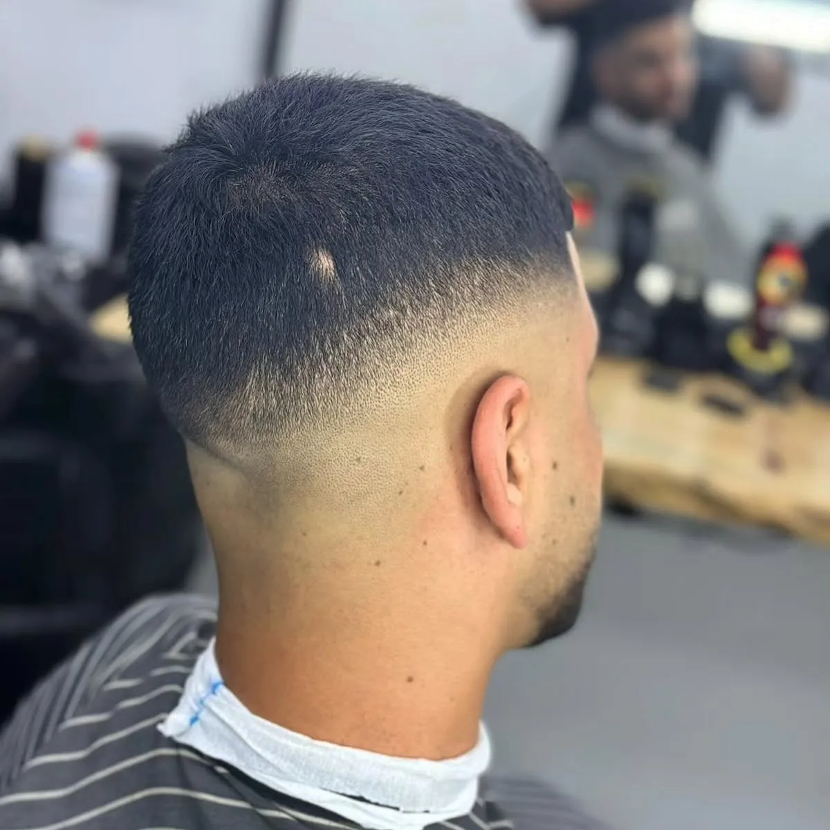 התחדשות עור הפנים