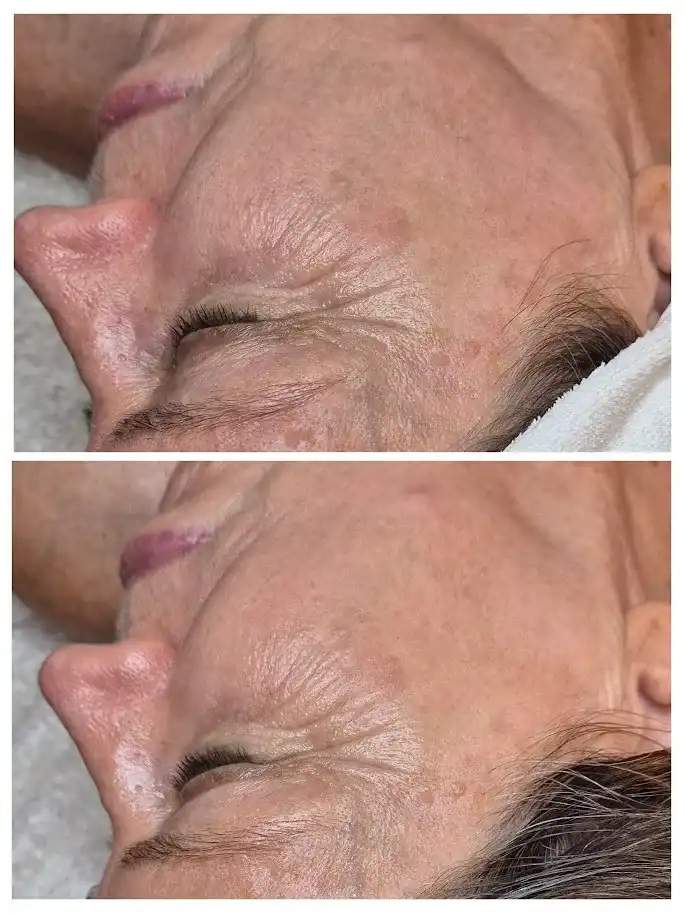 טיפולי זוהר- GLOW