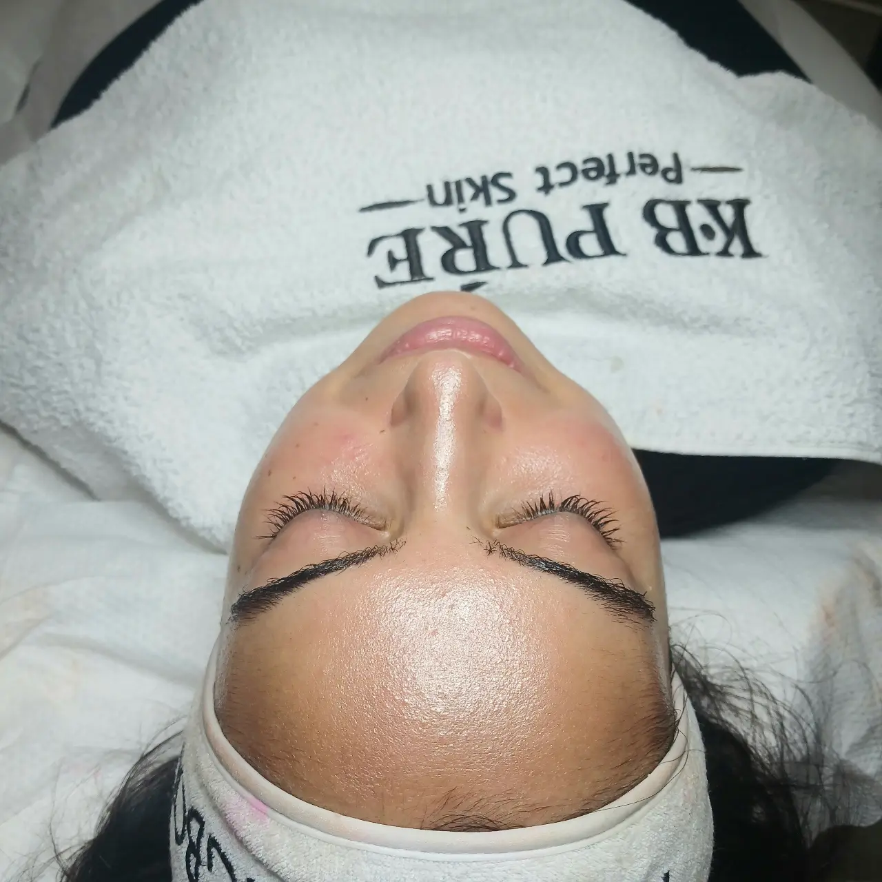 טיפול פנים קלאסי