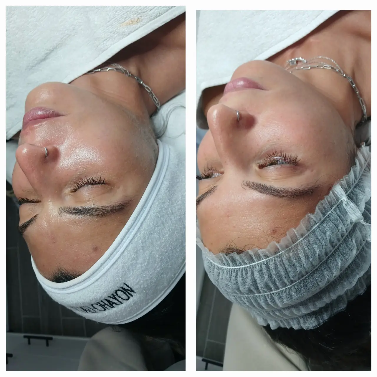 החדרת לחות באלקטרופורציה