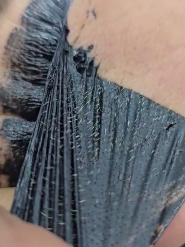 התחדשות עור הפנים