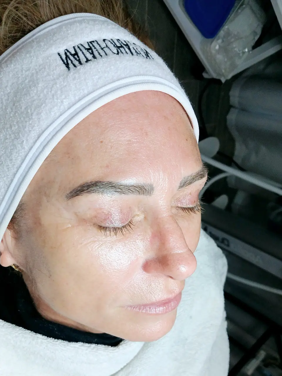 החדרת לחות באלקטרופורציה