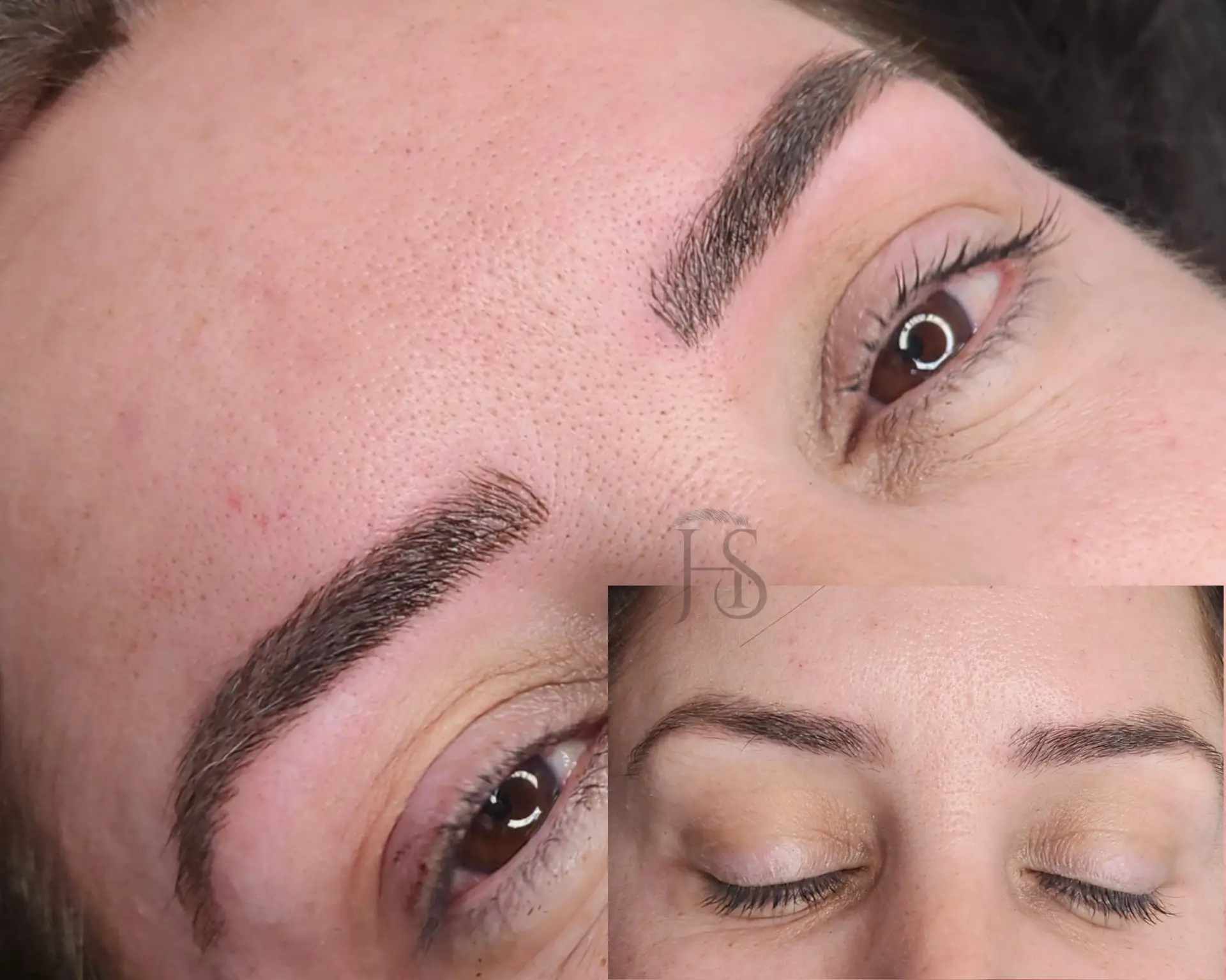 מיקרובליידינג