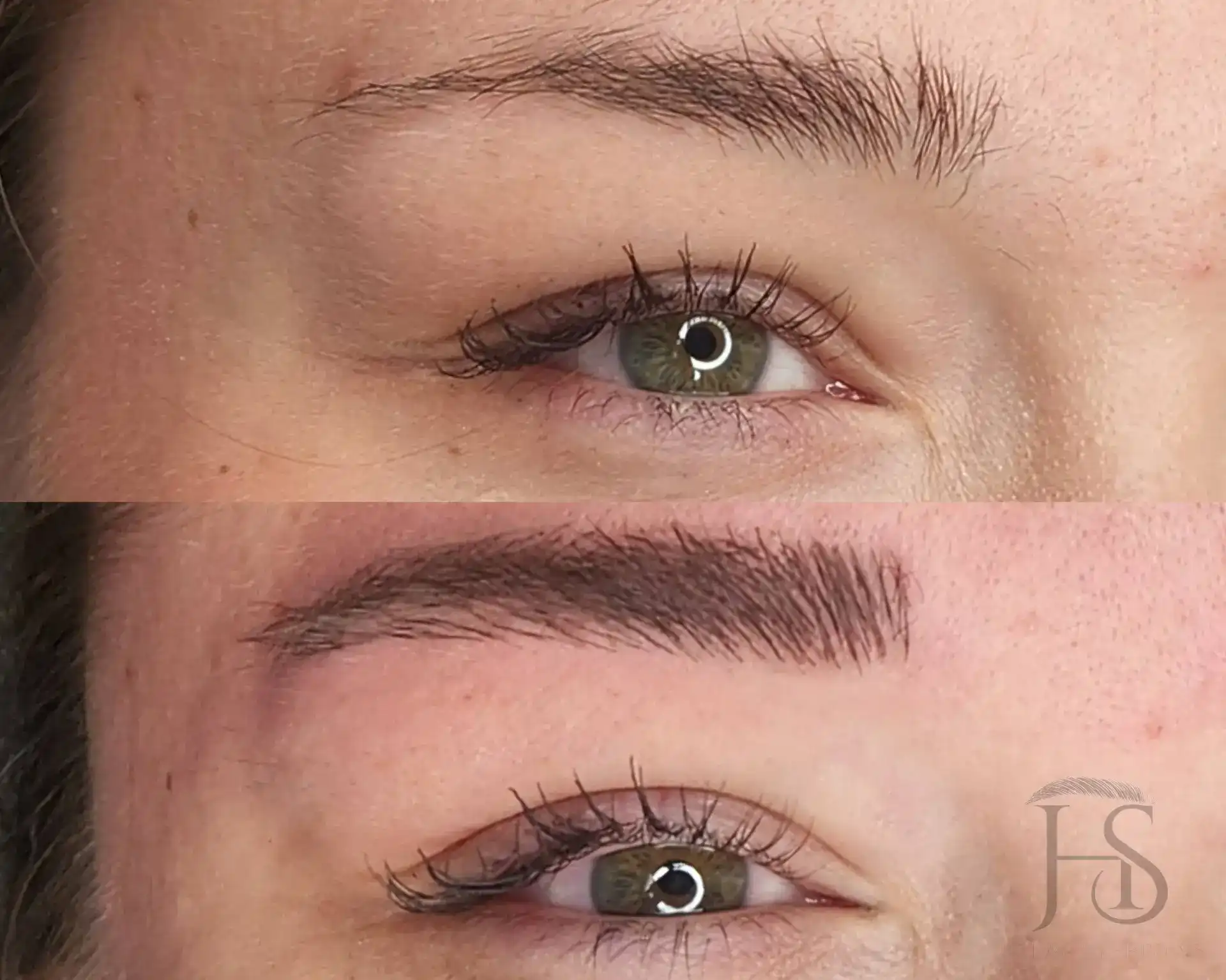 מיקרובליידינג