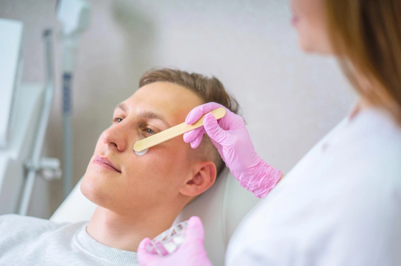 הסרת שיער פנים