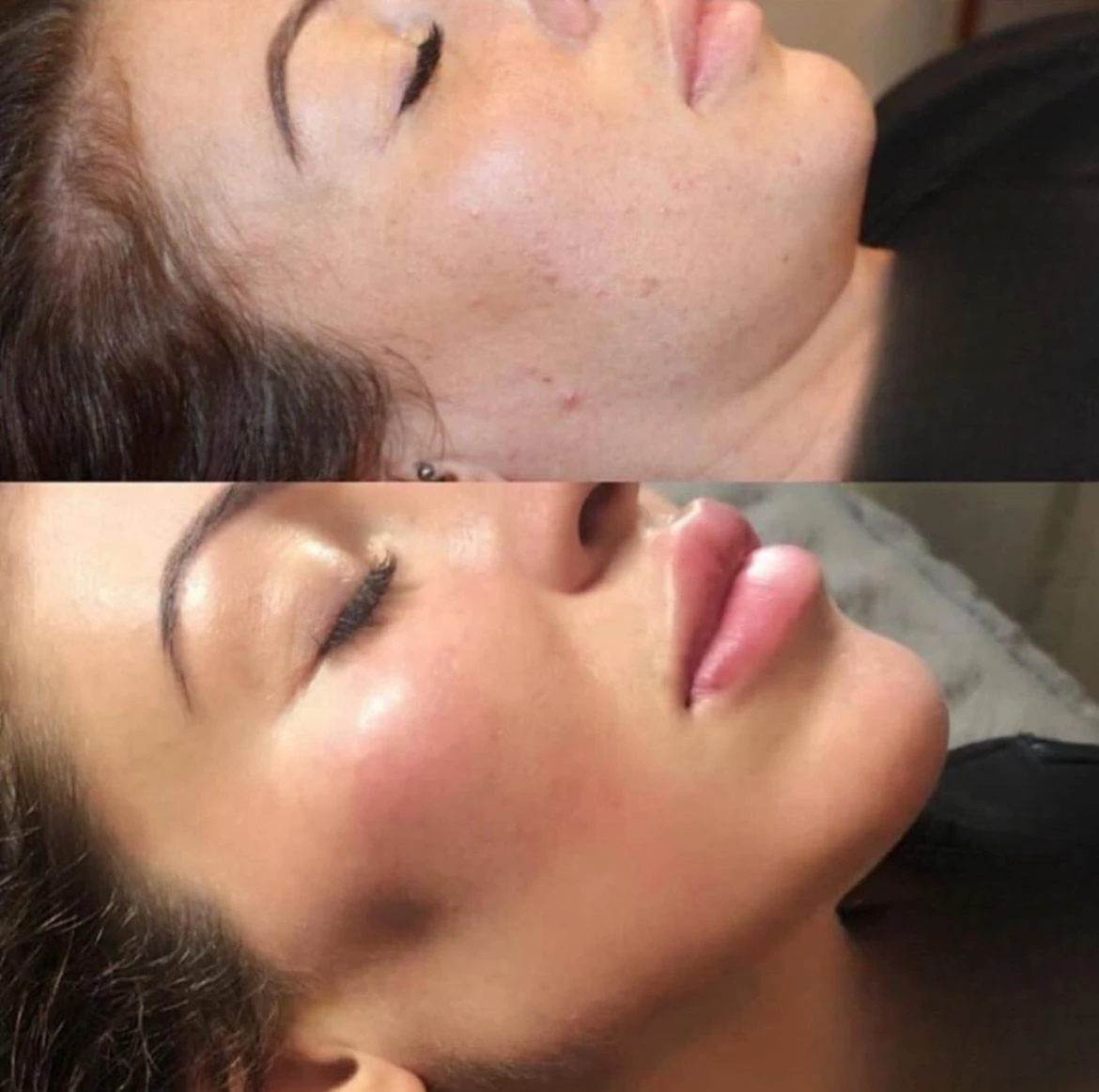 טיפולי אסתטיקה (הזרקות)