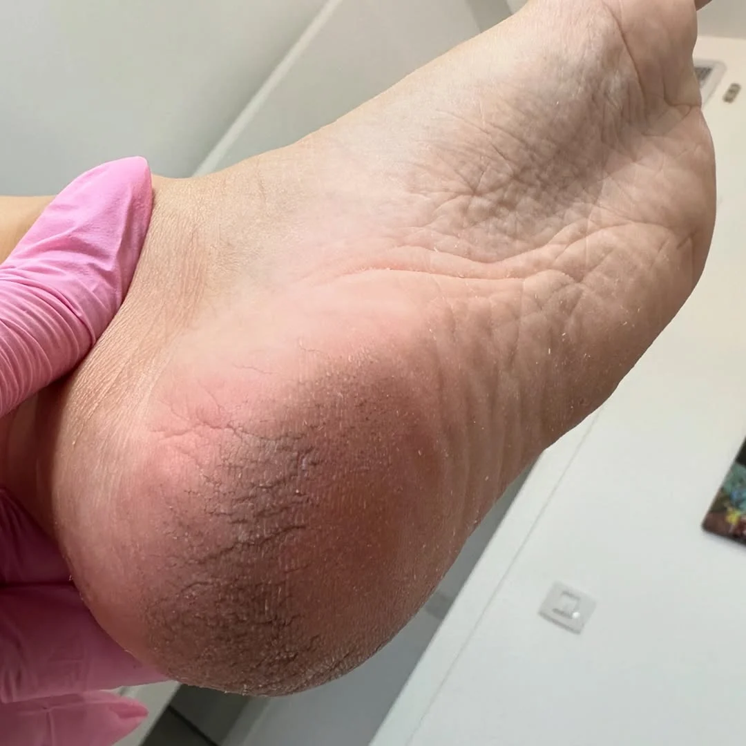 פדיקור קוסמטי