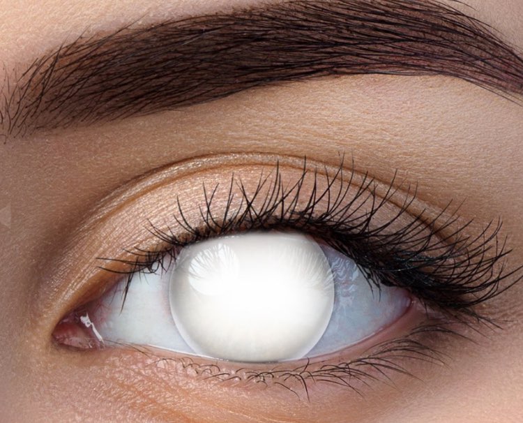 עדשות לבנות