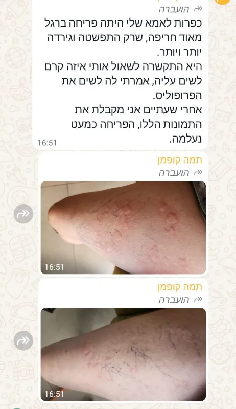 אלופרופוליס
