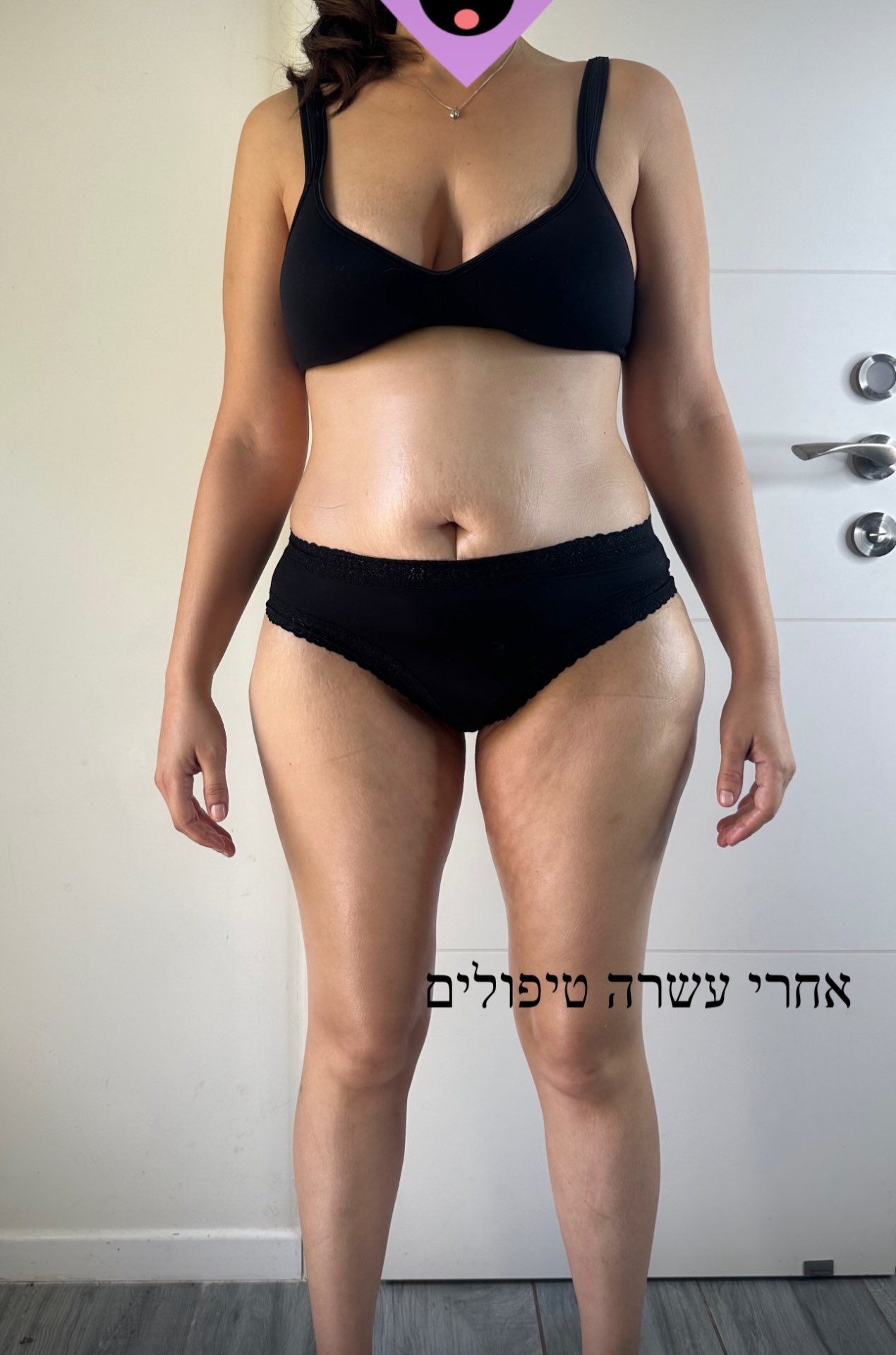 טיפולי גוף משולב - פרסותרפיה וואקום 