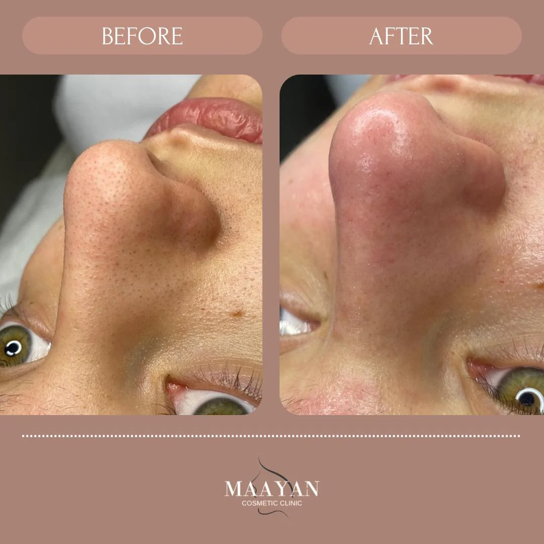  תוצאה מדהימה של ניקוז שחורים