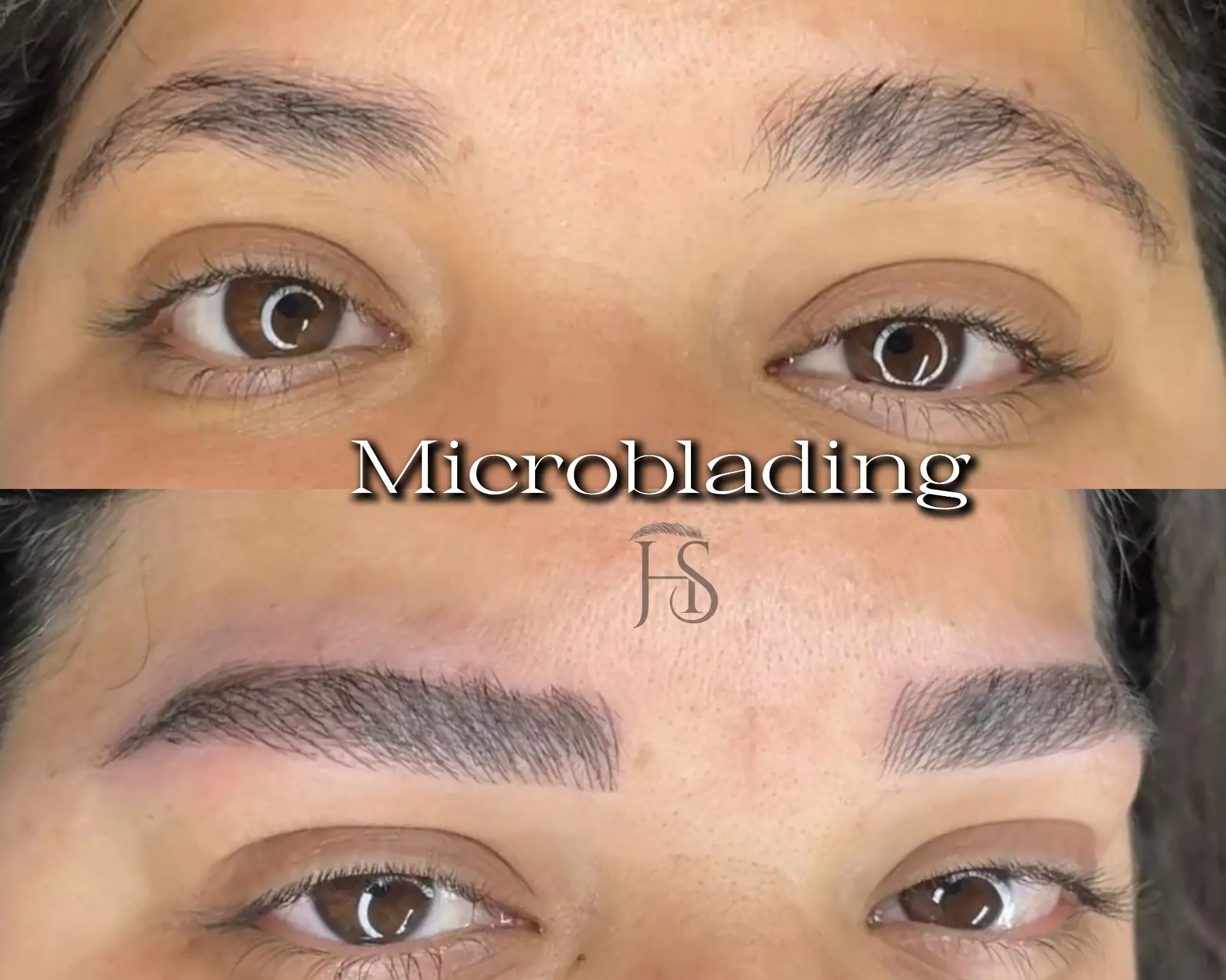 מיקרובליידינג