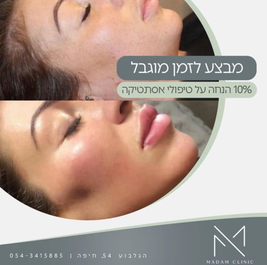 טיפולי אסתטיקה (הזרקות)