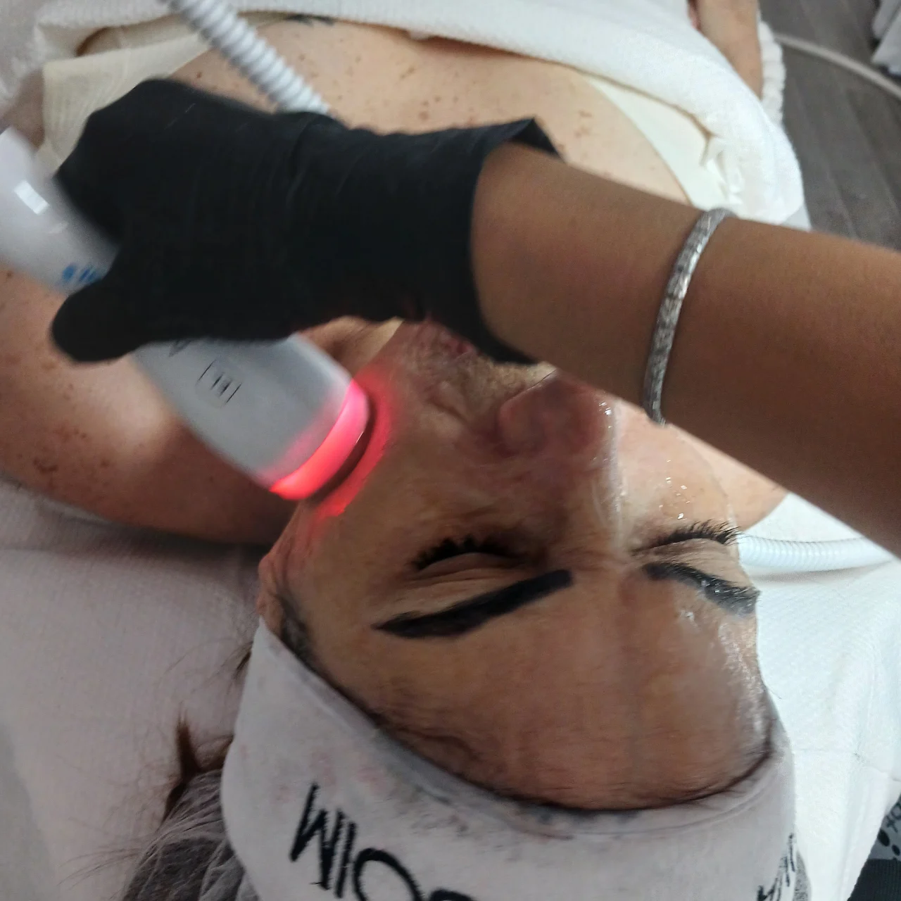 החדרת לחות באלקטרופורציה