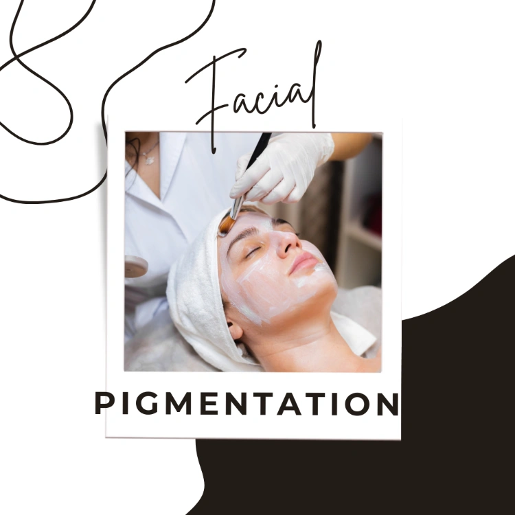 טיפולי פיגמנטציה