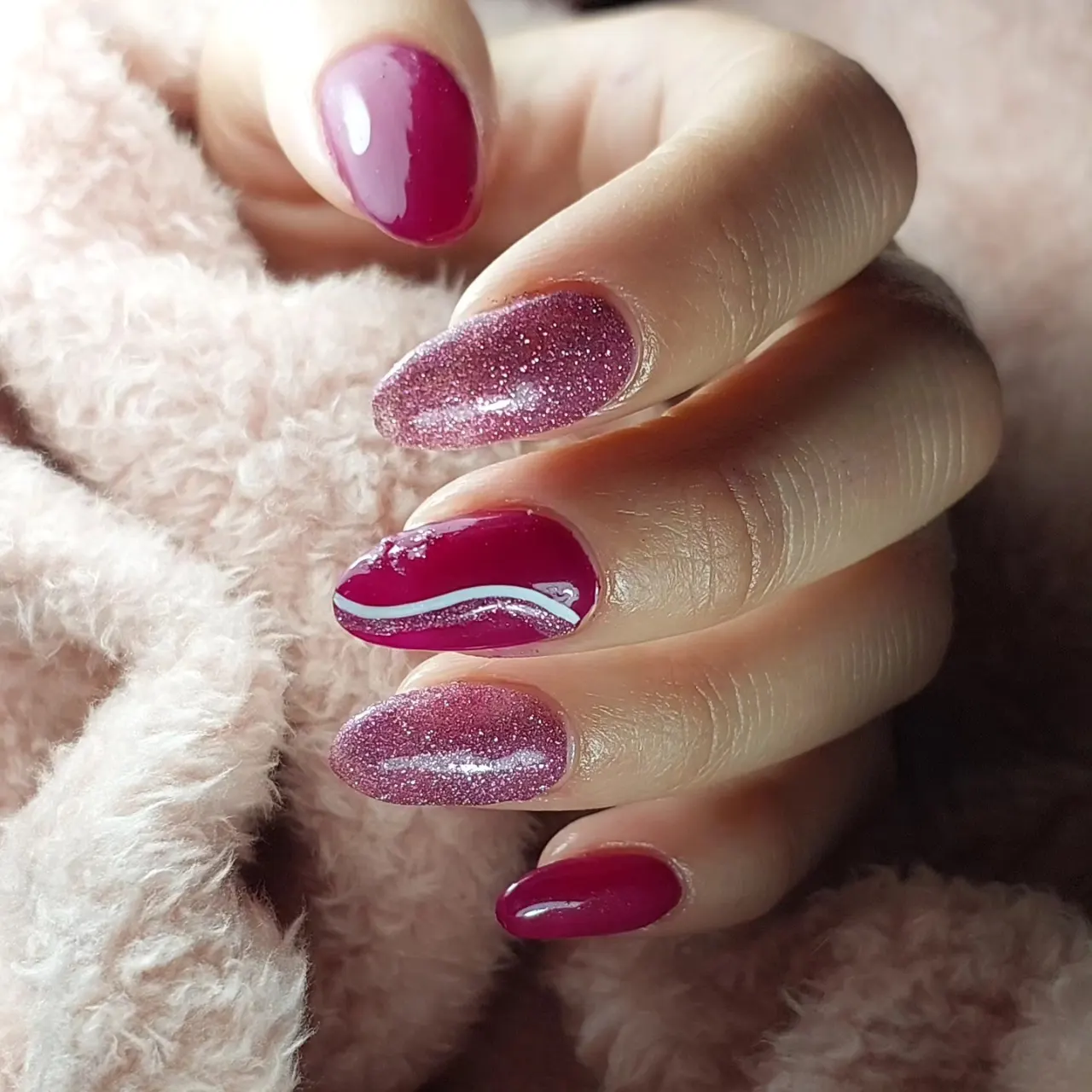 תיקון מבנה אנטומי עם לק ג'ל