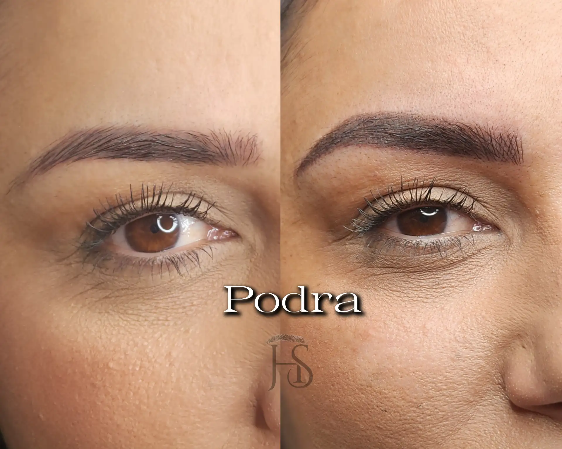 טיפול משולב