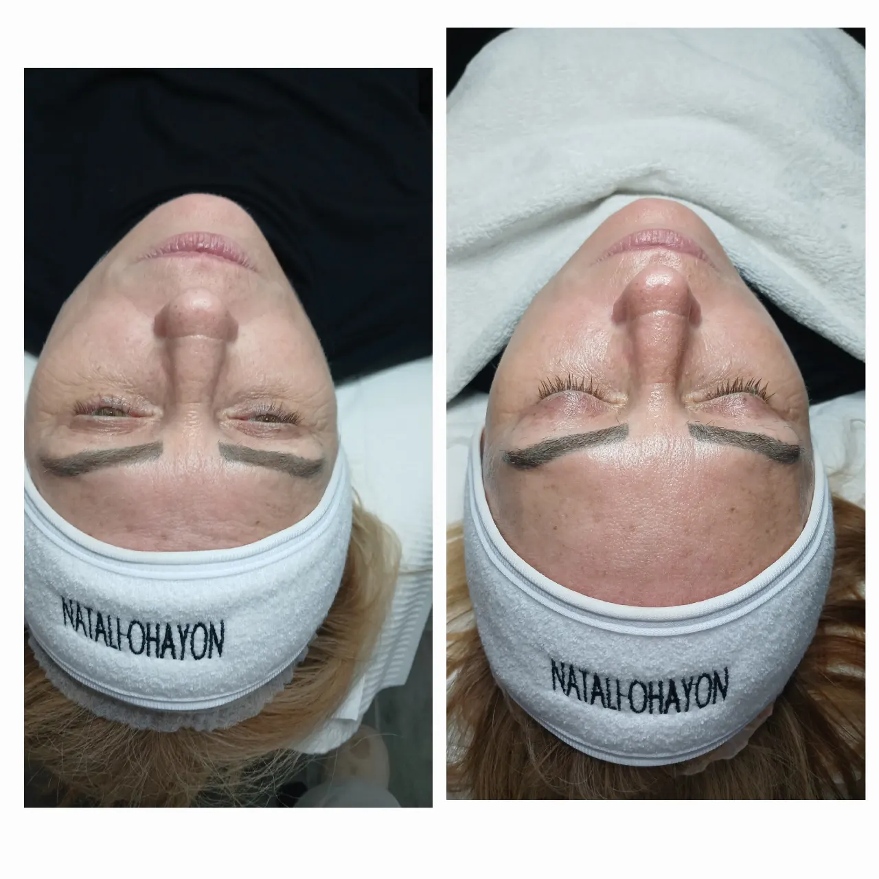 החדרת לחות באלקטרופורציה