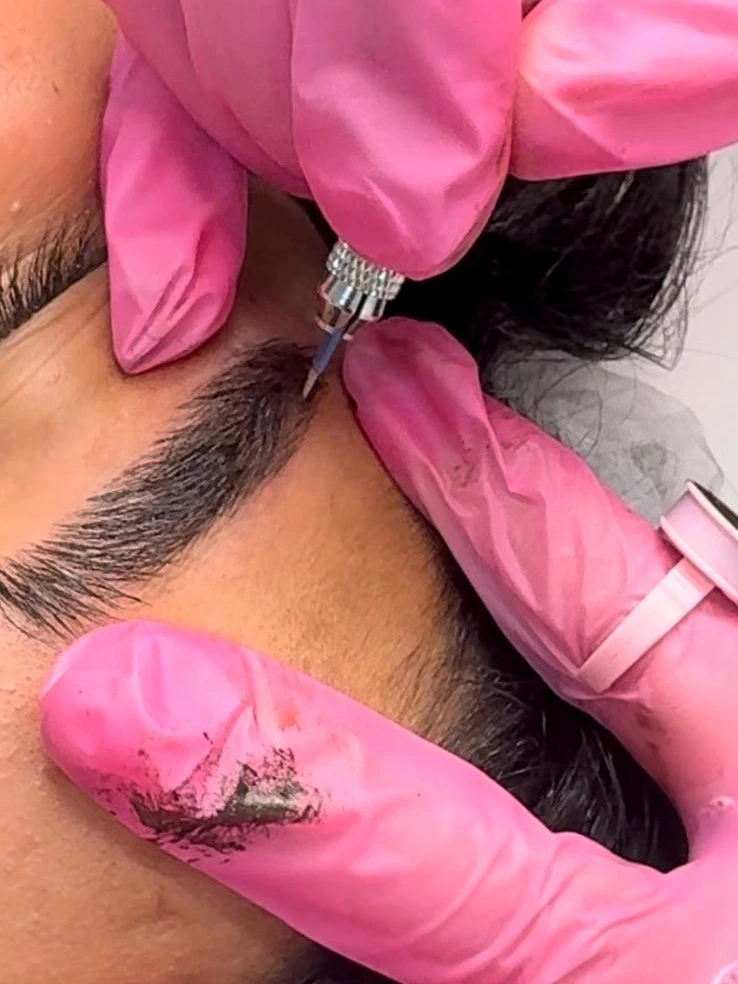 מתוך תהליך טיפול מיקרובליידינג