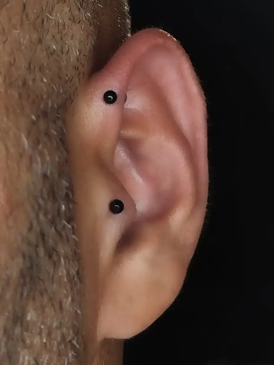 הליקס קדמי וטראגוס