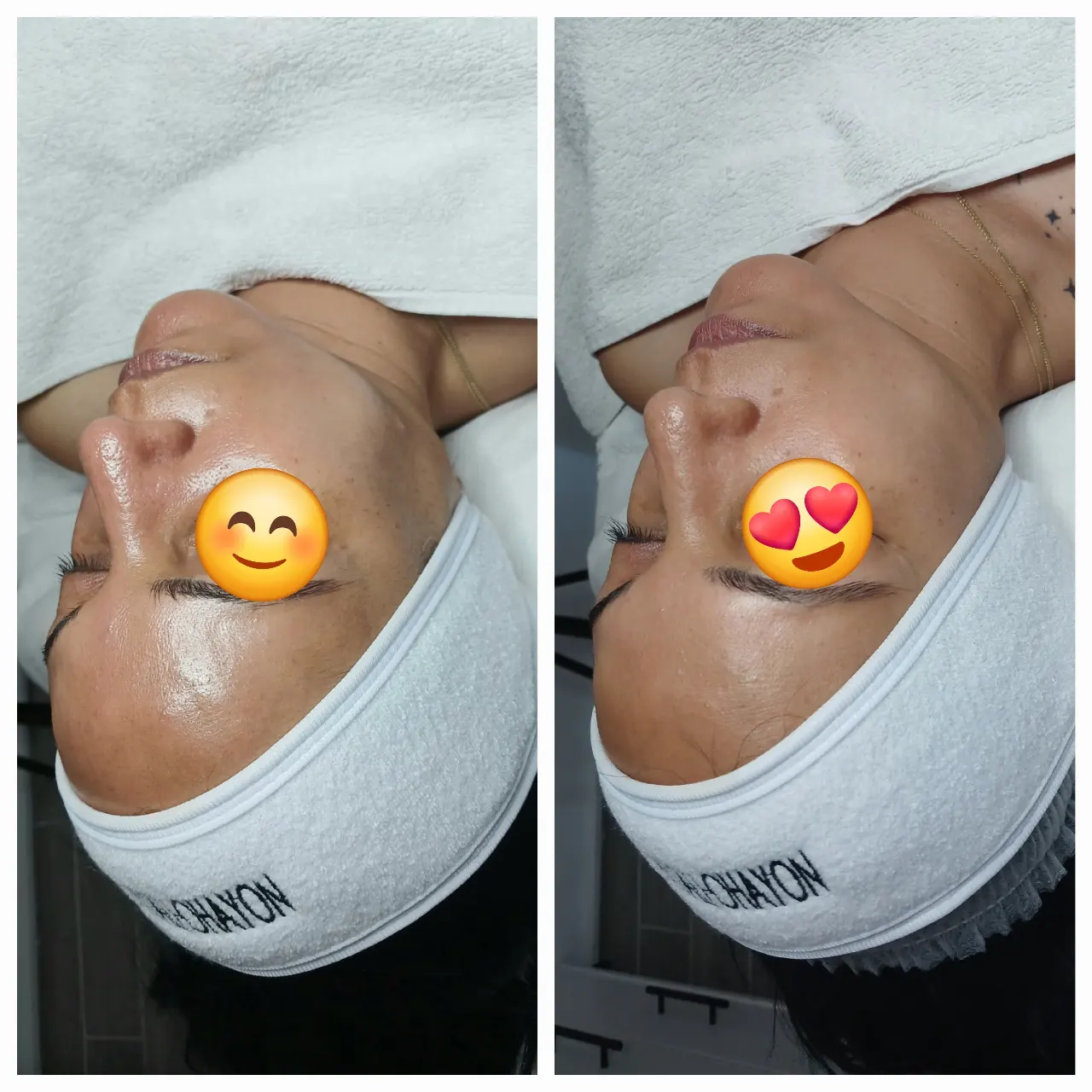 החדרת לחות באלקטרופורציה