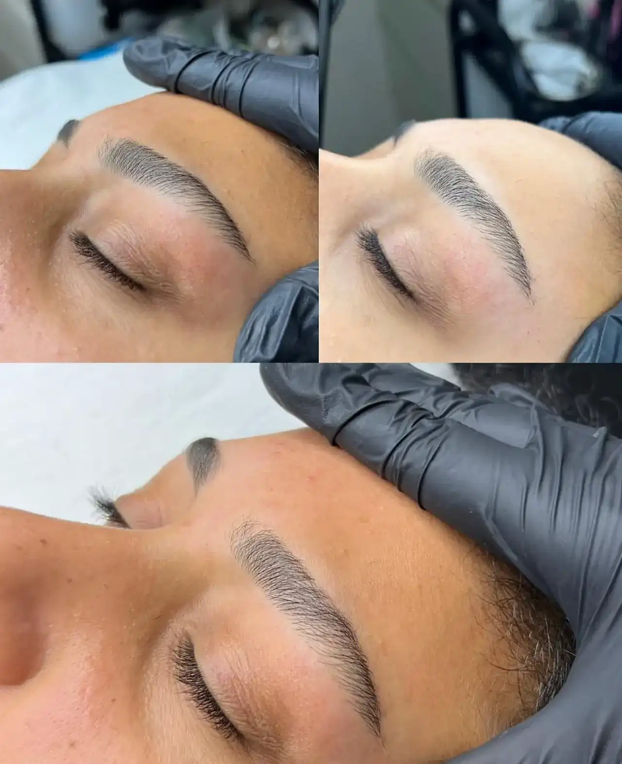 טיפולי מיקרובליידינג ומיקרושיידינג