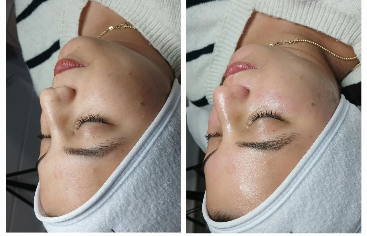  טיפול איזון ויופי לכלה