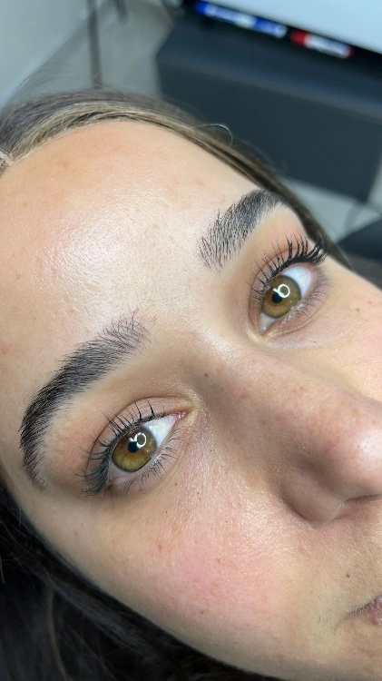 טיפול מיקרובליידינג| מיקרושיידינג